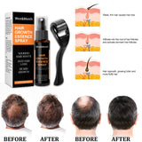 Hair Growth Spray, Anti-hair Loss, Nourishing Growth Liquid