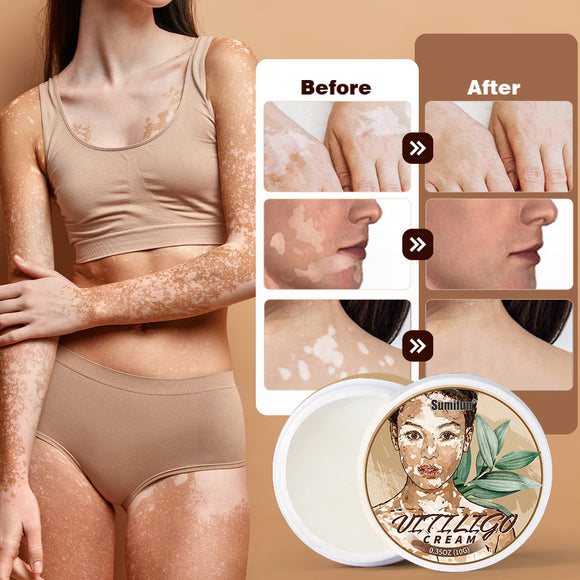 White Spot Care, Antibacterial Cream (Pack of 2)