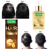 Soft and Refreshing, Hair Care Essential Oil