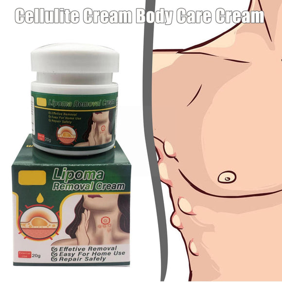 Chinese Herbs, Multiple Anti-tumor Lipoma Pain Cream (Pack of 2)