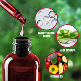 Fruit Acid Salicylic Acid Exfoliation, Closed Mouth Blackheads Acne, Shrinkage Treatment