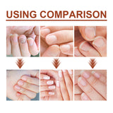 Thickening Nail Repair Serum for Hands and Feet – Improves Onychomycosis