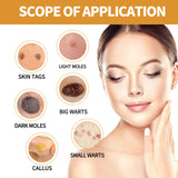 Skin Cleansing Wart Care Cream for External Use