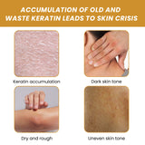 Turmeric Body Scrub Cream, Smallpox Diluting, Moisturizing, Refreshing, Smooth Skin Rejuvenation, Cleansing Body Cutin