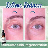 Painless Spot Nevus Repair Water