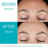 Women's Fading Wrinkle Retinol Serum