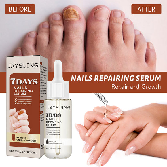 Thickening Nail Repair Serum for Hands and Feet – Improves Onychomycosis