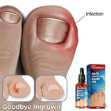 Bright Nail Repair Oil for Thickened Nail Grooves Treatment