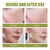 Fade Spot Repair, Dull Skin Whitening, Lightening Cream