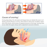 Relieve Congestion and Nasal Discomfort, Anti Snoring Nasal Spray (Pack of 2)