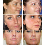 Retinol Face Cream Firming Lifting Anti-Aging Wrinkle-removing, Whitening Brightening Moisturizing Facial Skin Care