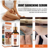 Dark Knuckle Brightening Serum – Skin Tone Evening & Dark Spot Care for Hands, Elbows and Knees